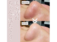 ルーク(Luke)の雰囲気(毛穴汚れ・黒ずみを徹底ケアし、透明感のあるお肌へ。)