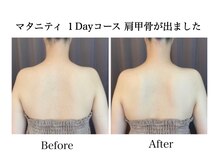 ナチュラーレ 天王寺店(Naturale)/痩身リンパマッサージ二の腕美脚