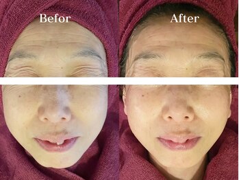 サロン アイプラス(salon i plus)の写真/年齢を重ねるほど、美しい素肌へ。