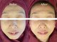 サロン アイプラス(salon i plus)の写真/年齢を重ねるほど、美しい素肌へ。