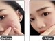 パッションヘアー(Passion Hair)の写真/受精卵の様な一番若い細胞でケア。iPS多能性幹細胞培養液を使用し輝く肌へ★