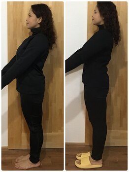 ヨサ パーク コアハート(YOSA PARK CORE HEART)/むくみスッキリ