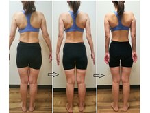 かんだ接骨院/48歳　骨盤ダイエット後面