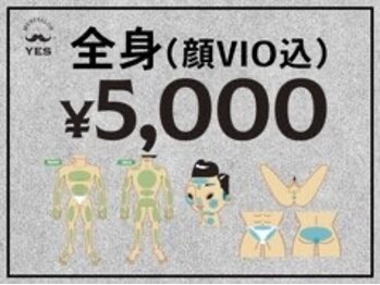 イエス 大阪難波店(YES)の写真/初回の方限定！「全身脱毛5,000円」！