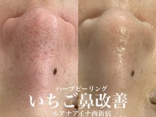 ルアナアイナ(Luana Aina)