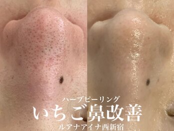 ルアナアイナ(Luana Aina)