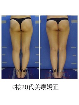 エステージ(estage)/