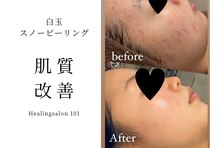 ヒーリングサロン イチマルイチ(101)