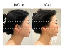 フロリール アザブジュウバン(FlorirAzabujuban)/3D小顔/造顔フェイシャル