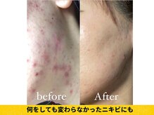 もう諦めないで！どこに行ってもダメだった方ぜひご相談ください