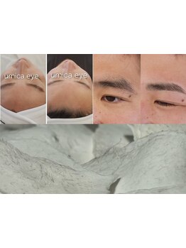 顔脱毛がしたい