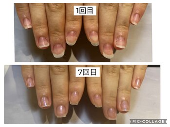 アンドネイル 海老名(&nail)/ジェルは塗らずに育てる！