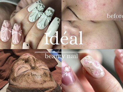 イデアル(Ideal)の写真