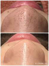 ベベクロスディディア 野々市市役所前店(Bebe×DiDiA)/お肌変化