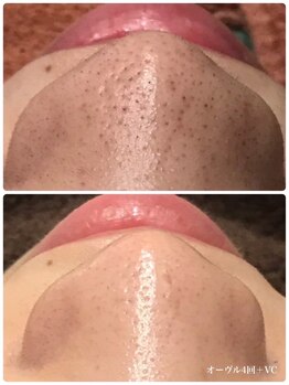 ベベクロスディディア 野々市市役所前店(Bebe×DiDiA)/お肌変化