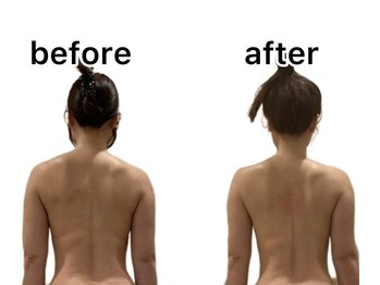 ビンナ 五反田店(Binna)/美骨矯正