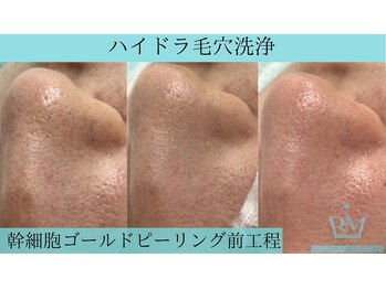 リメイククリニカルビューティー(Remake clinical beauty)/まずは土台を整える