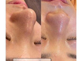 ミツレイ 九条店(MITUREI)/