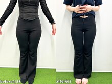 モア 札幌大通店(MORE)/長年の前もものハリが抜けた