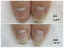 キアラネイル(Chiala nail)/ジェル育成