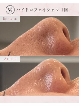 エンルーチェ(en;Luce)/気になる毛穴もつるん♪