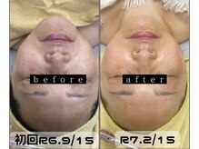 クレール 小山店(CLAIR)/【美肌フォト+エレポレ】