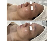 コアラッシュ(COA LASH)/トライアルスキンケア