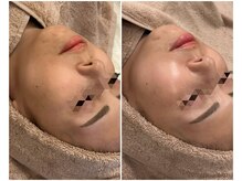 アマテラススキンラウンジ(Amatelas SKIN LOUNGE)