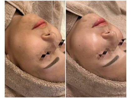 アマテラススキンラウンジ(Amatelas SKIN LOUNGE)の写真