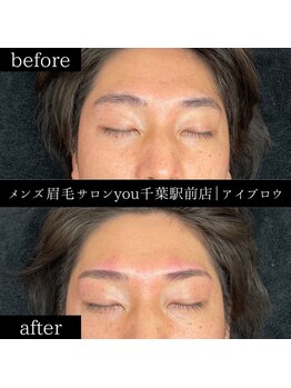 ユー 千葉駅前店(you)/ビフォ－アフター写真