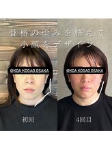 コア 中目黒店(Koa)/お客様ビフォーアフター！！