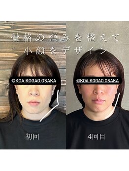 コア 中目黒店(Koa)/お客様ビフォーアフター!!