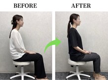 イロハ 鳥取米子店(IROHA)/【美容整体のビフォーアフター】