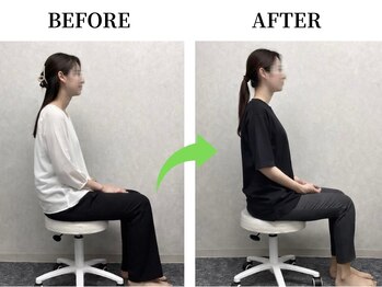 イロハ 鳥取米子店(IROHA)/【美容整体のビフォーアフター】