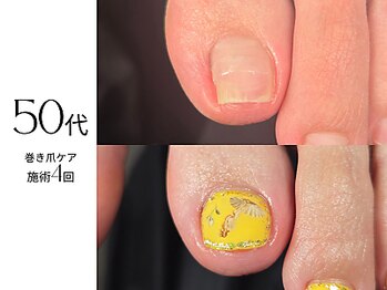 爪の広がりが一目瞭然♪
