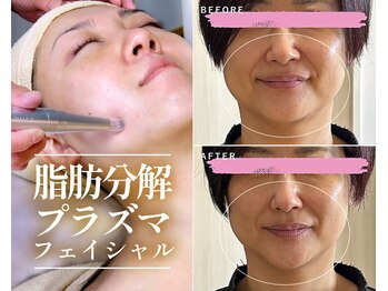 シュシュ(Chouchou)の写真/!脂肪分解×エイジングケアの融合！話題のレモンボトルの進化版【レッドショット】で弾むハリ肌＆小顔へ♪