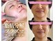 シュシュ(Chouchou)の写真/!脂肪分解×エイジングケアの融合！話題のレモンボトルの進化版【レッドショット】で弾むハリ肌＆小顔へ♪