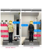 ナオル整体 池袋院(NAORU整体)/正面の姿勢変化【池袋 整体】
