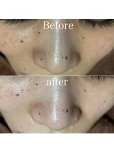 ペイジ(peige)/【peige】症例写真