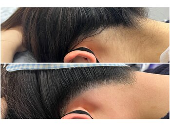 サロン ラズリ 久留米店(SALON Lazuli)/【うなじ脱毛】横からもキレイ＊