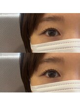 フィービー(pheebe)/カールデザイン