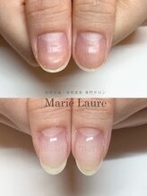 マリーロール 梅田店(Marie Laure)/ネイルケア深爪改善/自爪育成/
