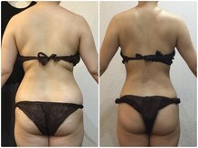 美容整体ウェリナ 中川八田院/小顔矯正/骨盤矯正/痩身整体