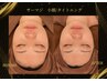 韓国最新RFサーマジ【小顔・Vライン形成】ほうれい線、二重あご改善¥12800