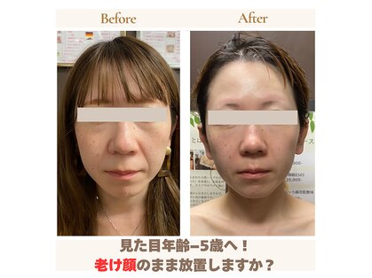 グレースヴィラ(GRACE VILLA)の写真