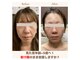 グレースヴィラ(GRACE VILLA)の写真