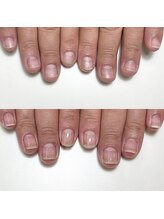 ルクレール カシェット(Le clair cachette)/美爪育成コース