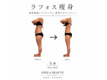 アネラボーテ(Anela Beaute)の雰囲気（ラフォスボディ　根本改善/痩身/ブライダル/アフターケア◎）