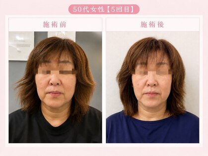 小顔美肌ファクトリー 金沢院の写真