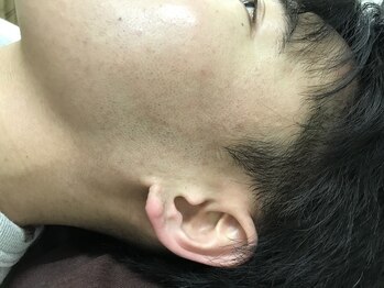 ナノハナ/鹿沼市全身脱毛の美容室ナノハナ